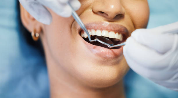 Best Emergency Dental Care for Sports Injuries in Ladd, IL